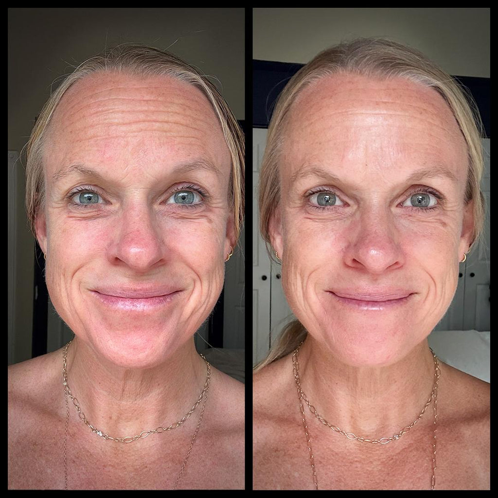 Anti Aging Vitamin C Facial Mist with Rose Hydrosol