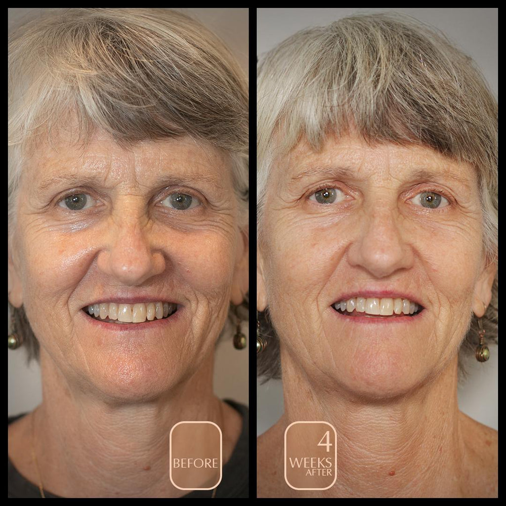 before and after four weeks woman mid sixties from the glow starter kit Aureterra botanical peptide repair cream, anti aging facial polish, anti aging facial mist with vitamin C