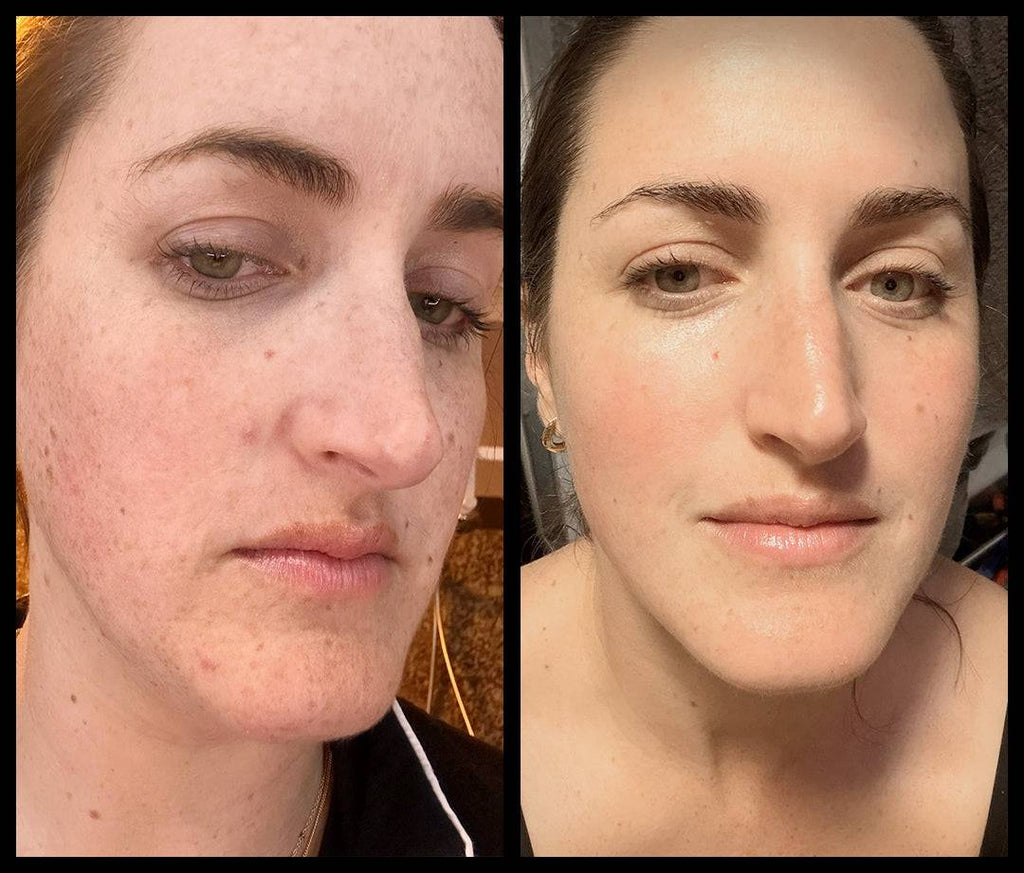 Botanical Peptide Repair Cream