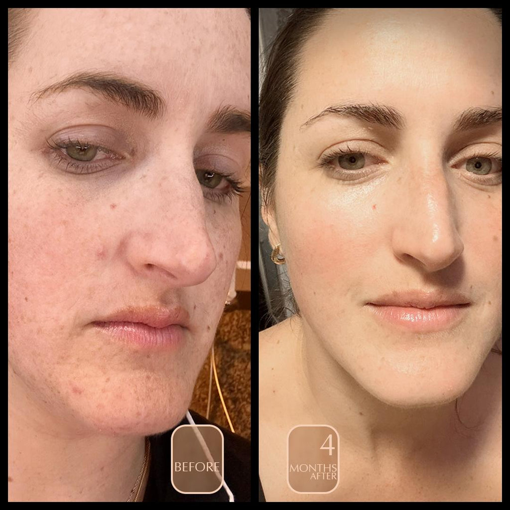 before and after anti aging facial polish botanical cleanser and exfoliant