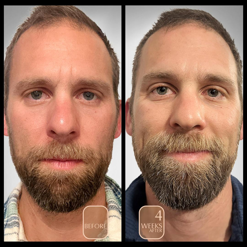 before and after male mid thirties anti aging facial polish brighten and tighten skin