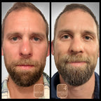 before and after male mid thirties anti aging facial polish brighten and tighten skin