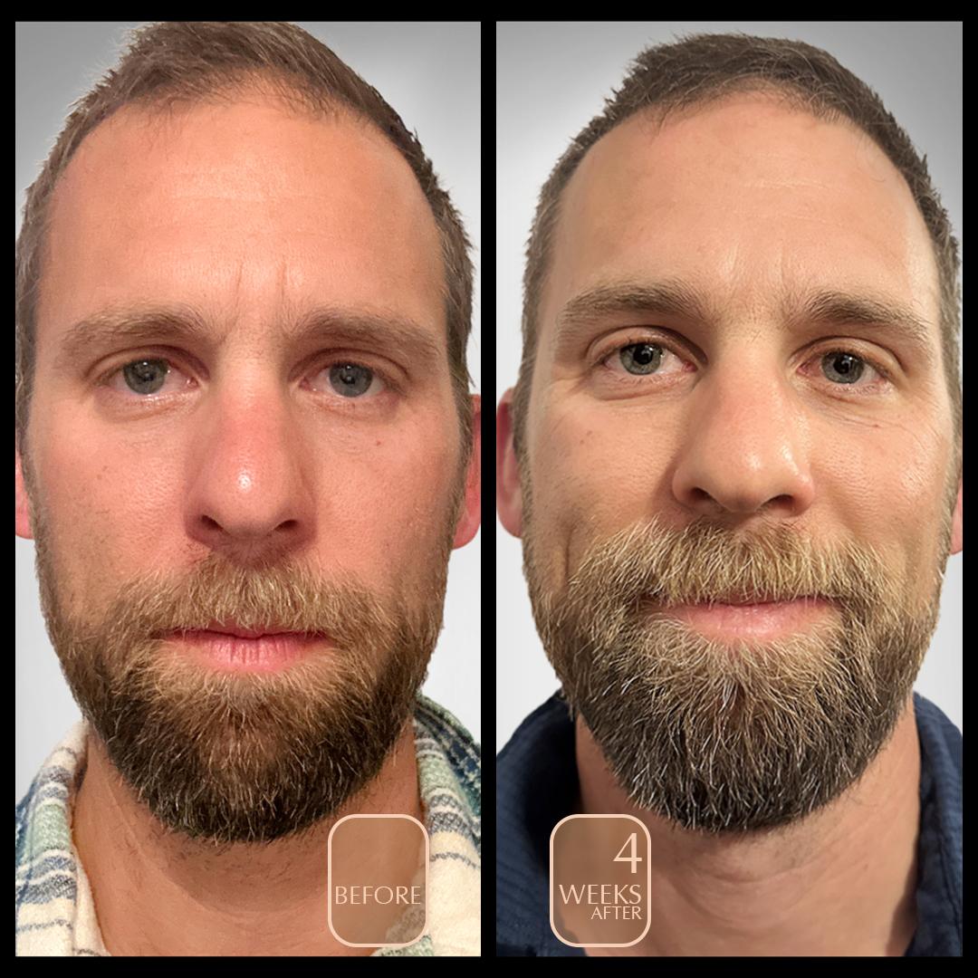 before and after male mid thirties anti aging facial polish brighten and tighten skin