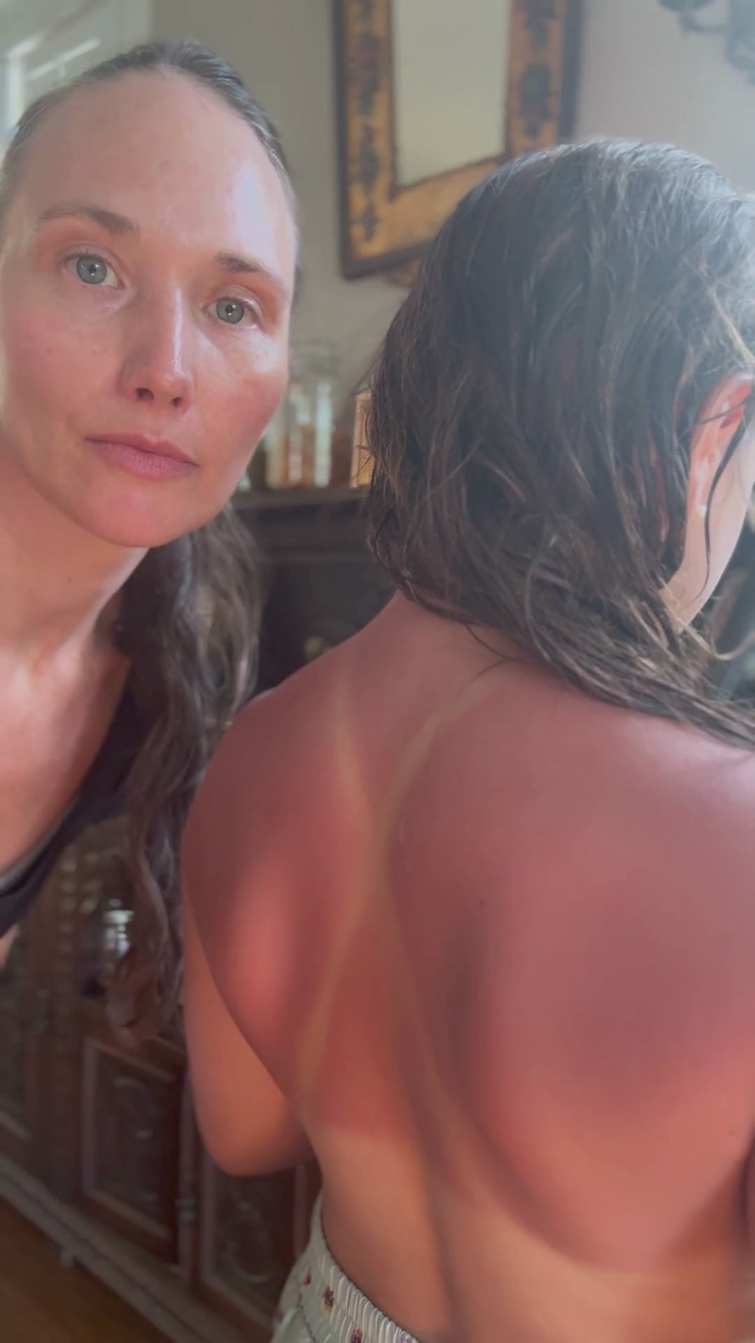 How to use The Everything Salve on sunburn
